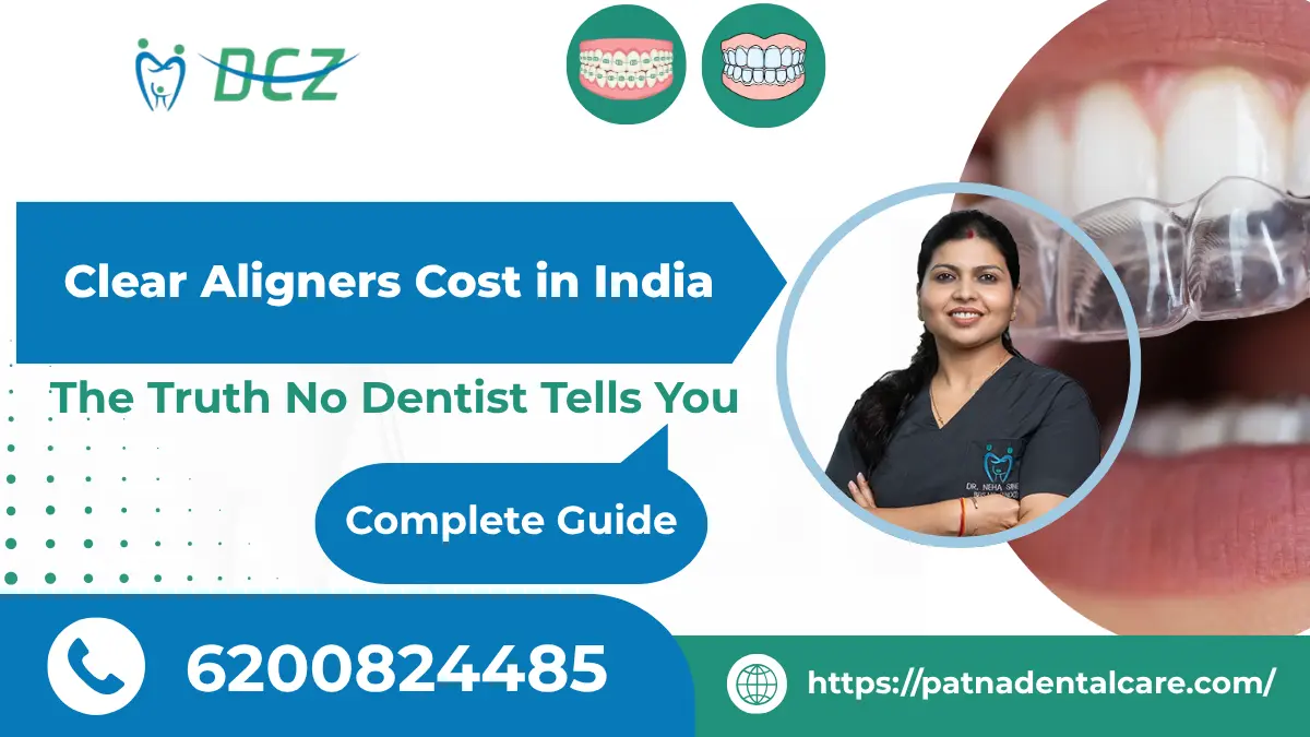 Clear Aligners Cost in India