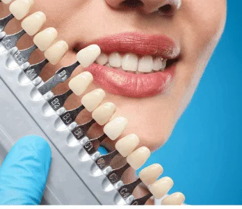 Cosmetic dentistry and smile makeover in Patna