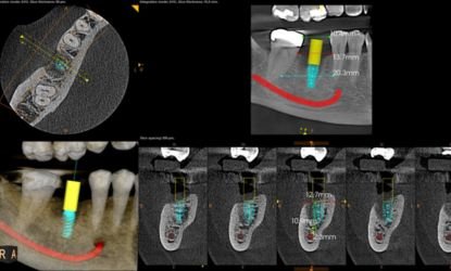 Multiplanar CBCT images showing teeth and jaw structures