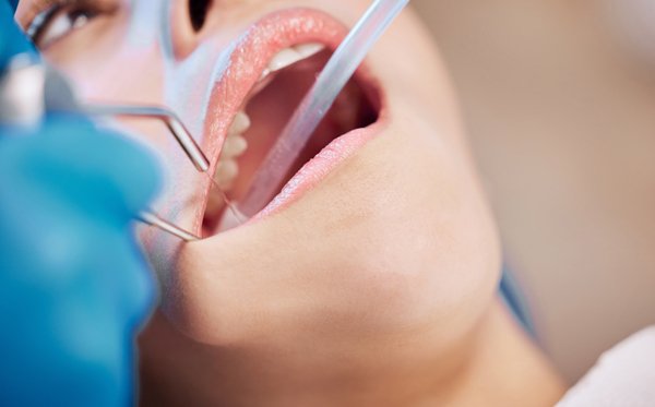 Dentist reviewing aftercare and follow-up after cosmetic dentistry treatment in Patna