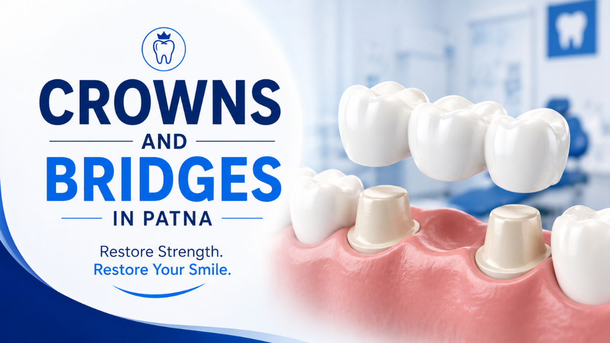 Crowns and bridges in Patna for restoring damaged and missing teeth