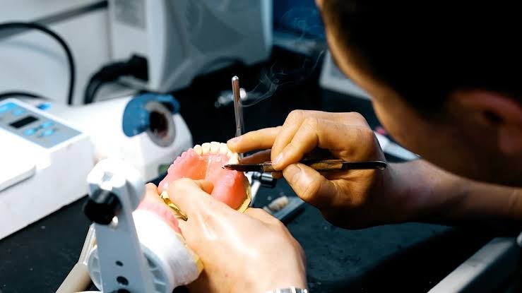 Dentist performing final fitting of custom crown and bridge restoration in Patna
