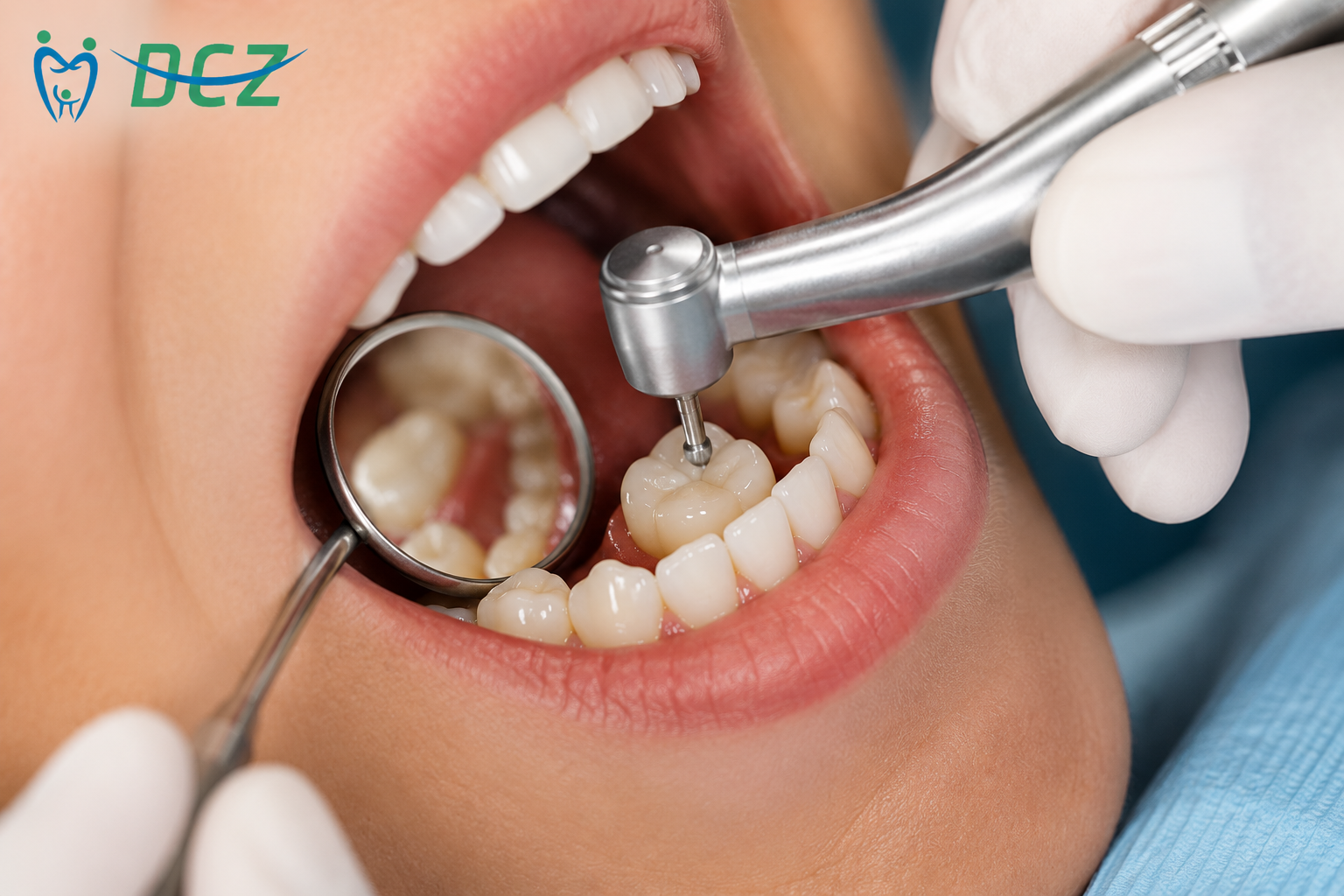 Dentist shaping and adjusting a dental filling on a patient's tooth using professional dental instruments.