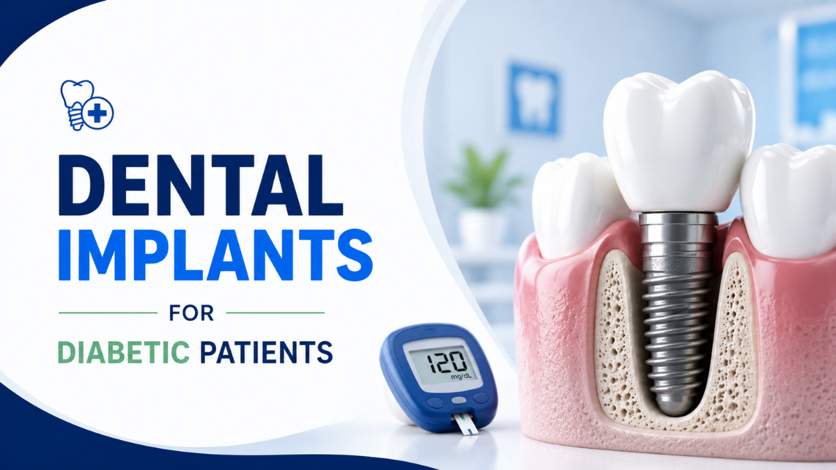 How Dental Implants for Diabetic Patients
