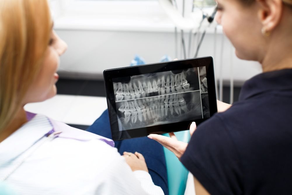 Digital X-ray used for accurate diagnosis before crowns and bridges treatment in Patna