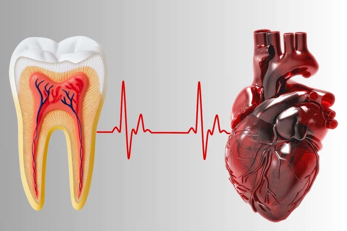 The Connection Between Gum Disease and Heart Disease