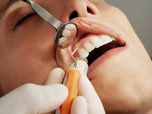 Gum flap surgery for treating advanced gum disease and periodontal infection in Patna