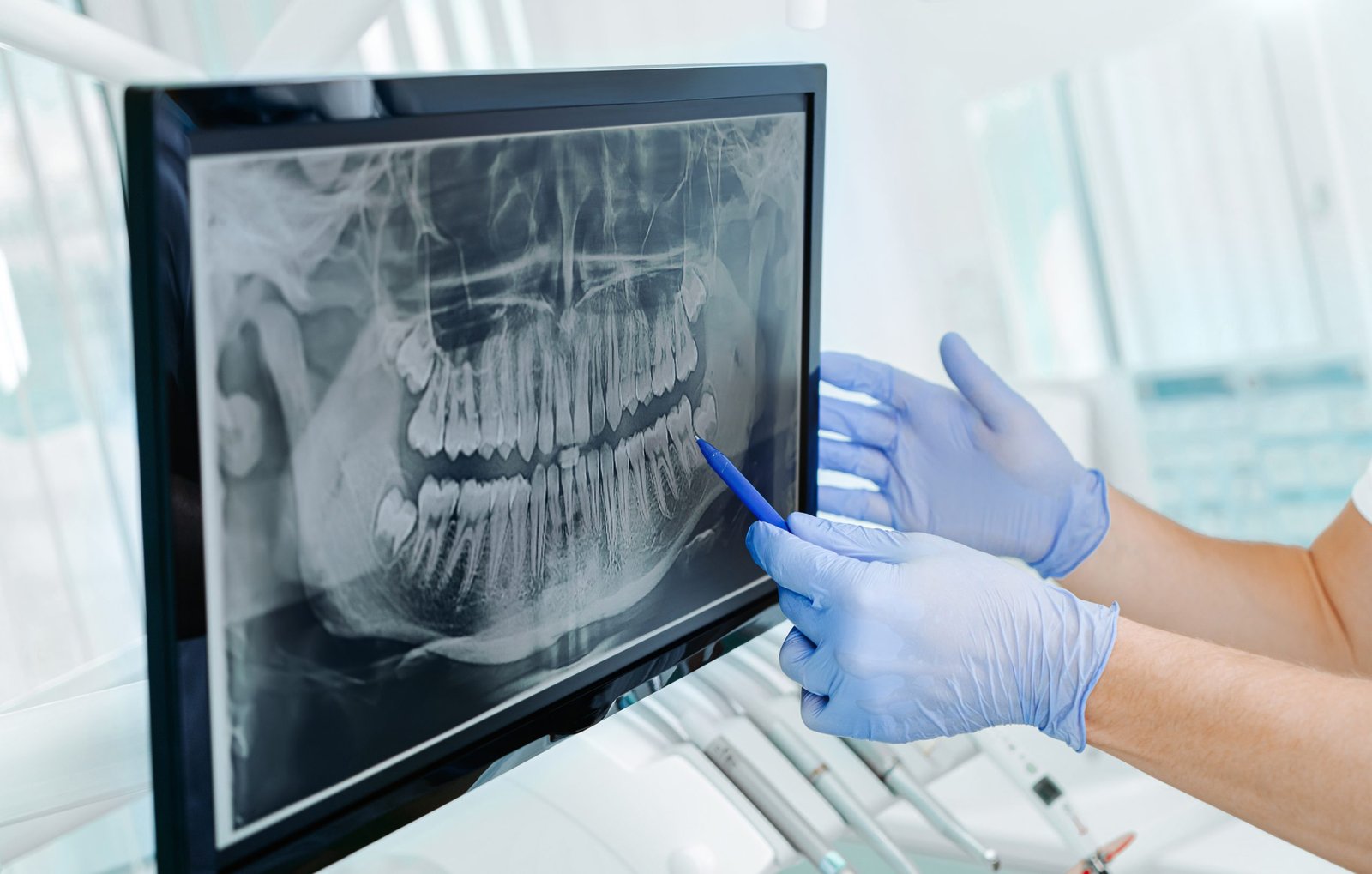 Dentist reviewing diagnosis and cancer staging results for oral cancer treatment in Patna