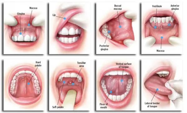 Dentist performing oral examination before teeth scaling and cleaning in Patna