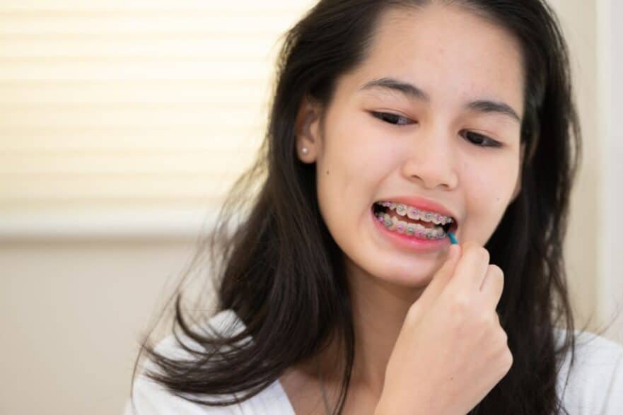 Orthodontist adjusting braces during a regular follow-up visit in Patna