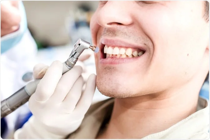 Teeth polishing treatment for a smooth, stain-free finish at Dental Comfort Zone