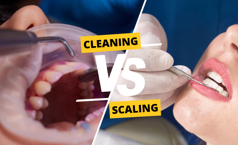 Dentist performing professional teeth scaling and cleaning to remove tartar and plaque from a patient&amp;amp;#039;s teeth in Patna.