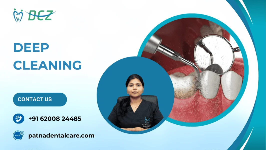 Teeth Deep Cleaning services in Patna