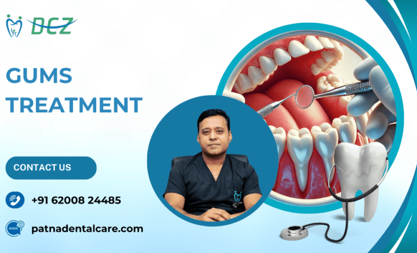 Gums Treatment