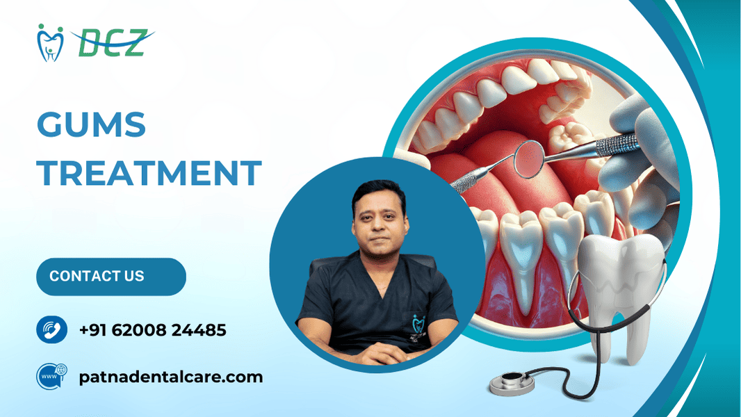 Gums Treatment