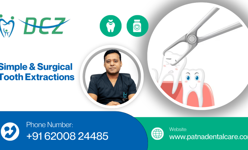 Simple & Surgical Tooth Extractions