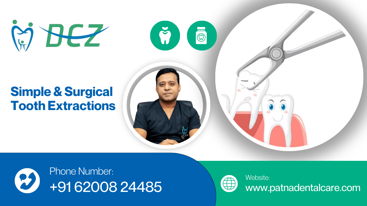 Simple & Surgical Tooth Extractions
