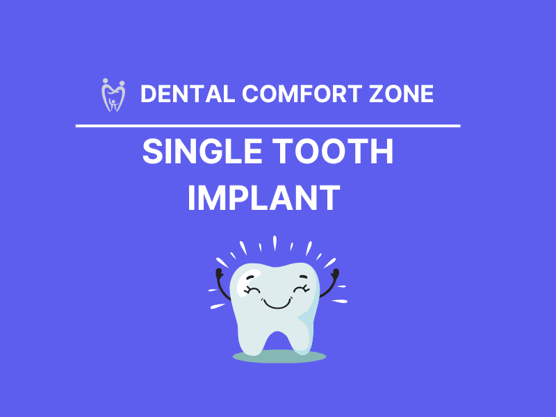 Single Tooth Implant