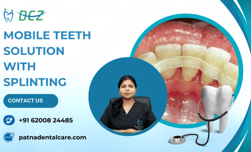 Mobile Teeth Solution with Splinting