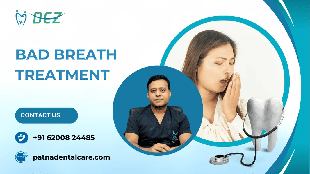 Bad Breath Treatment in Patna