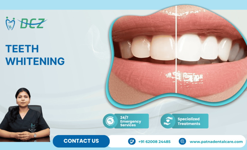 Teeth Whitening