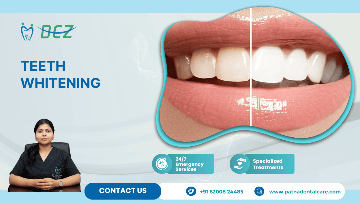 Teeth Whitening