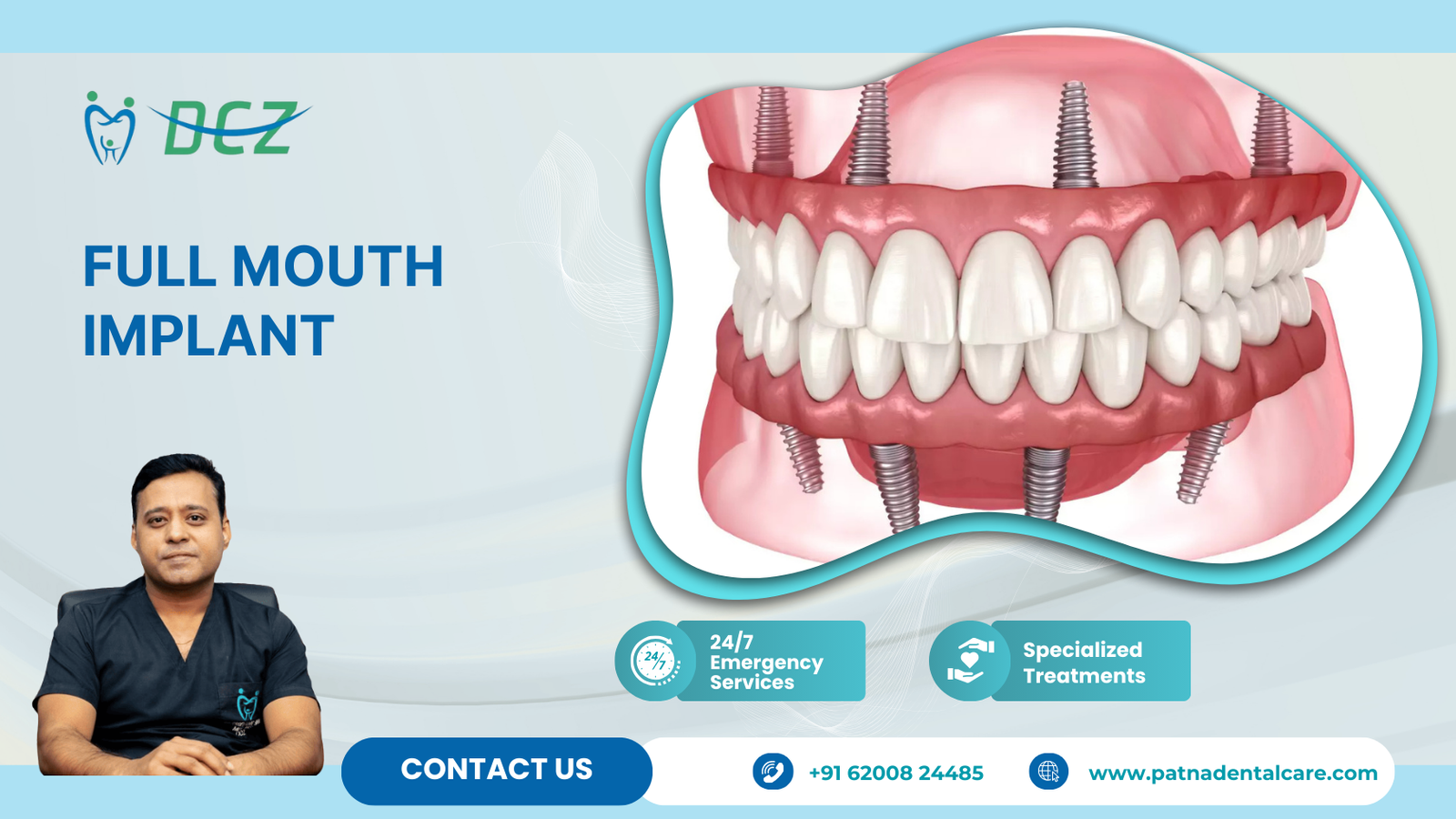 Full mouth implant patna