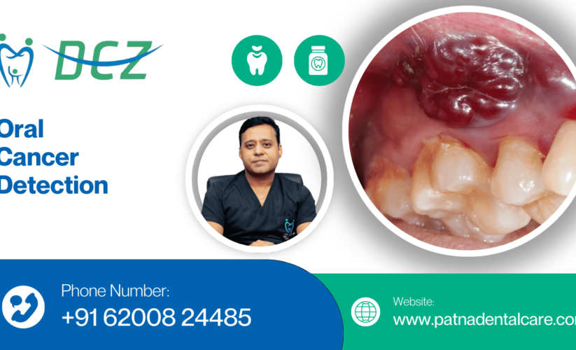 Oral Cancer Detection