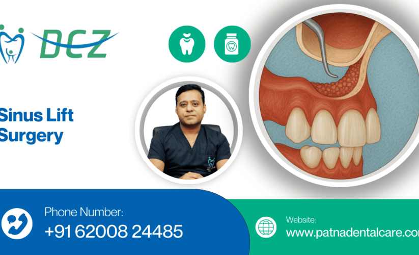 Sinus Lift Surgery