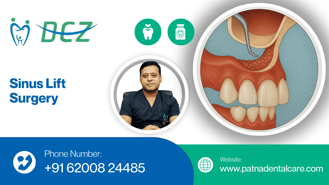 Sinus Lift Surgery