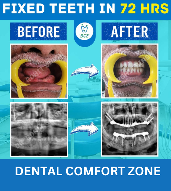 Home Patna Dental Care