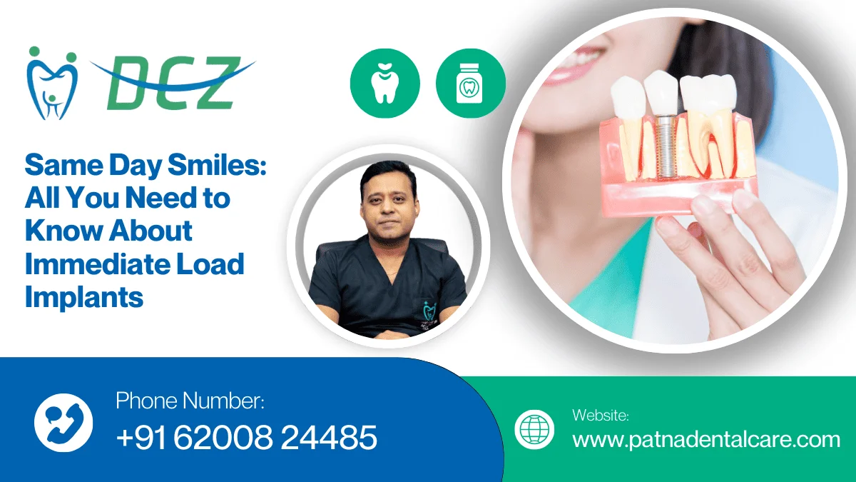 Immediate Load Implants services in Patna