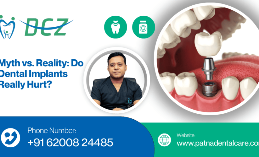 Myth vs. Reality: Do Dental Implants Really Hurt?