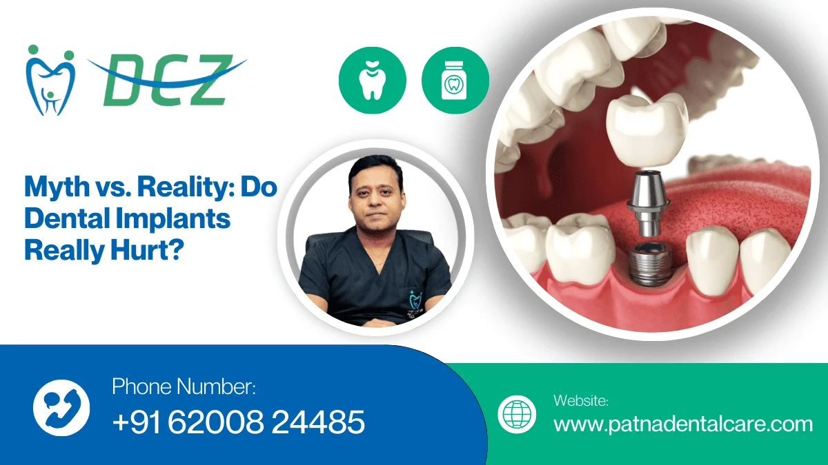 Dental Implants in patna