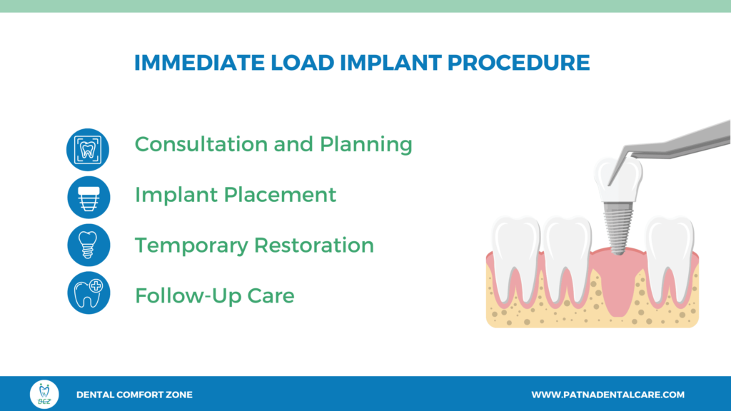 Smiling patient with immediate load implants for a restored same-day smile