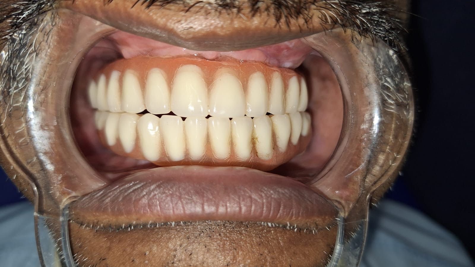 WhatsApp Image 2024 09 03 at 7.15.21 PM