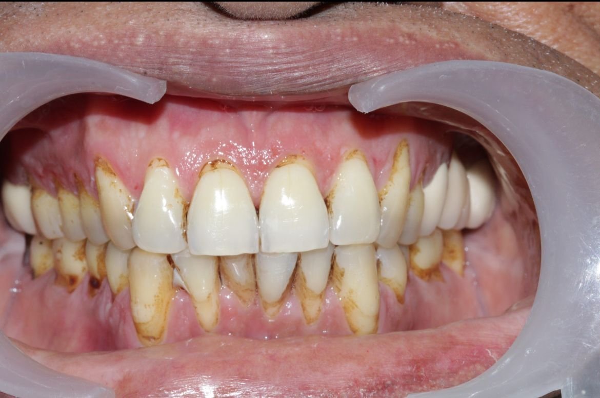 WhatsApp Image 2024 09 03 at 7.16.53 PM