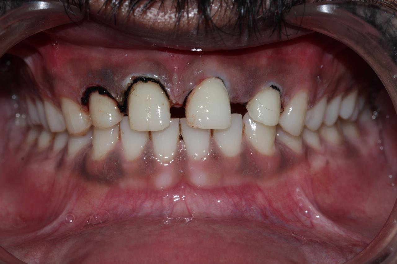 WhatsApp Image 2024 09 04 at 5.26.55 PM