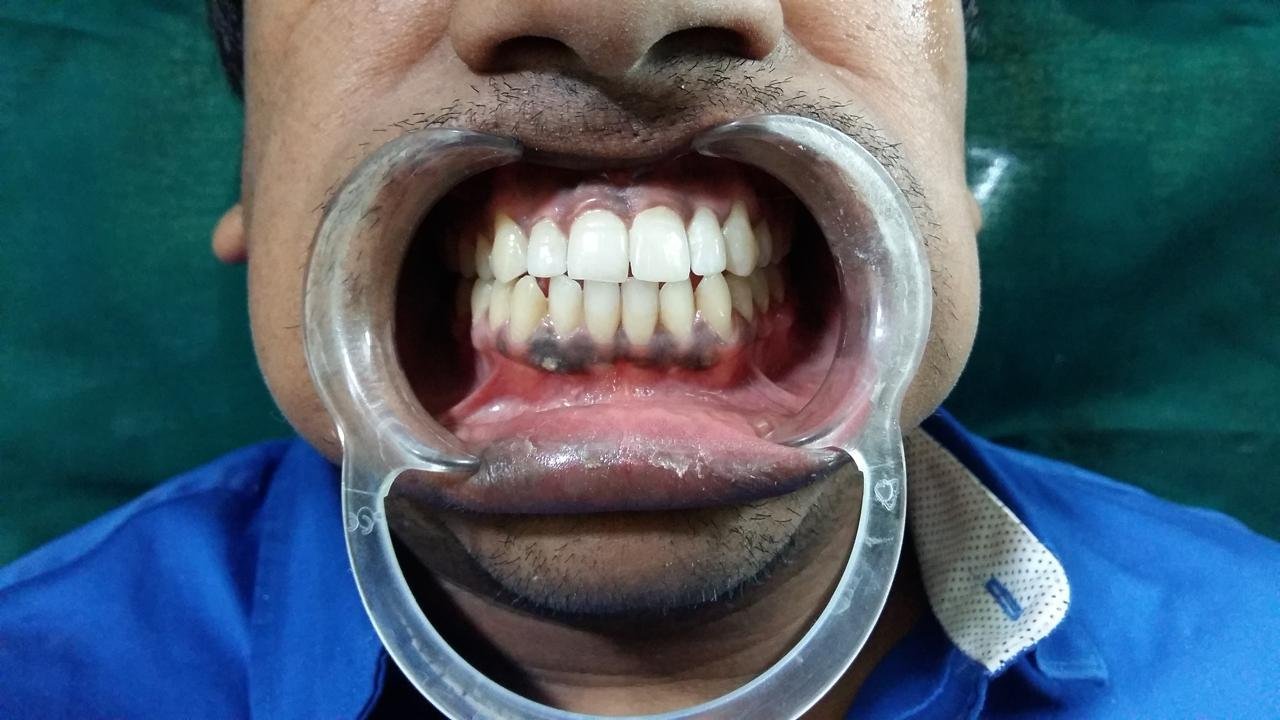 WhatsApp Image 2024 09 04 at 5.27.27 PM 1