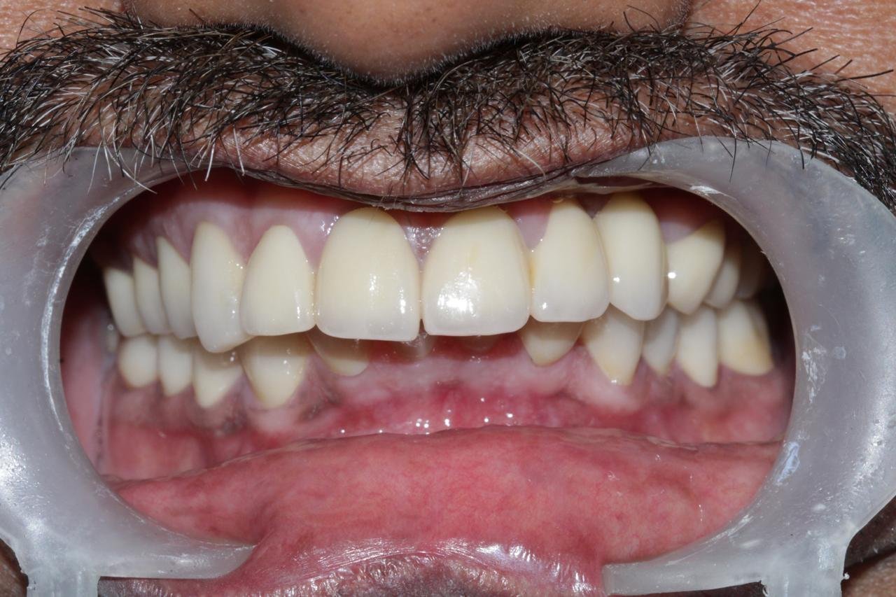 WhatsApp Image 2024 09 04 at 9.13.45 PM 1