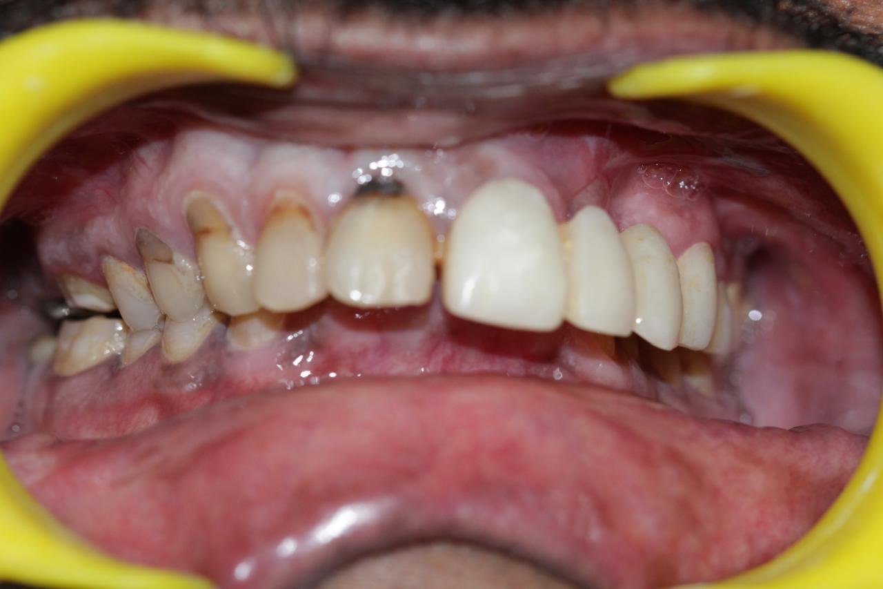 WhatsApp Image 2024 09 04 at 9.13.45 PM