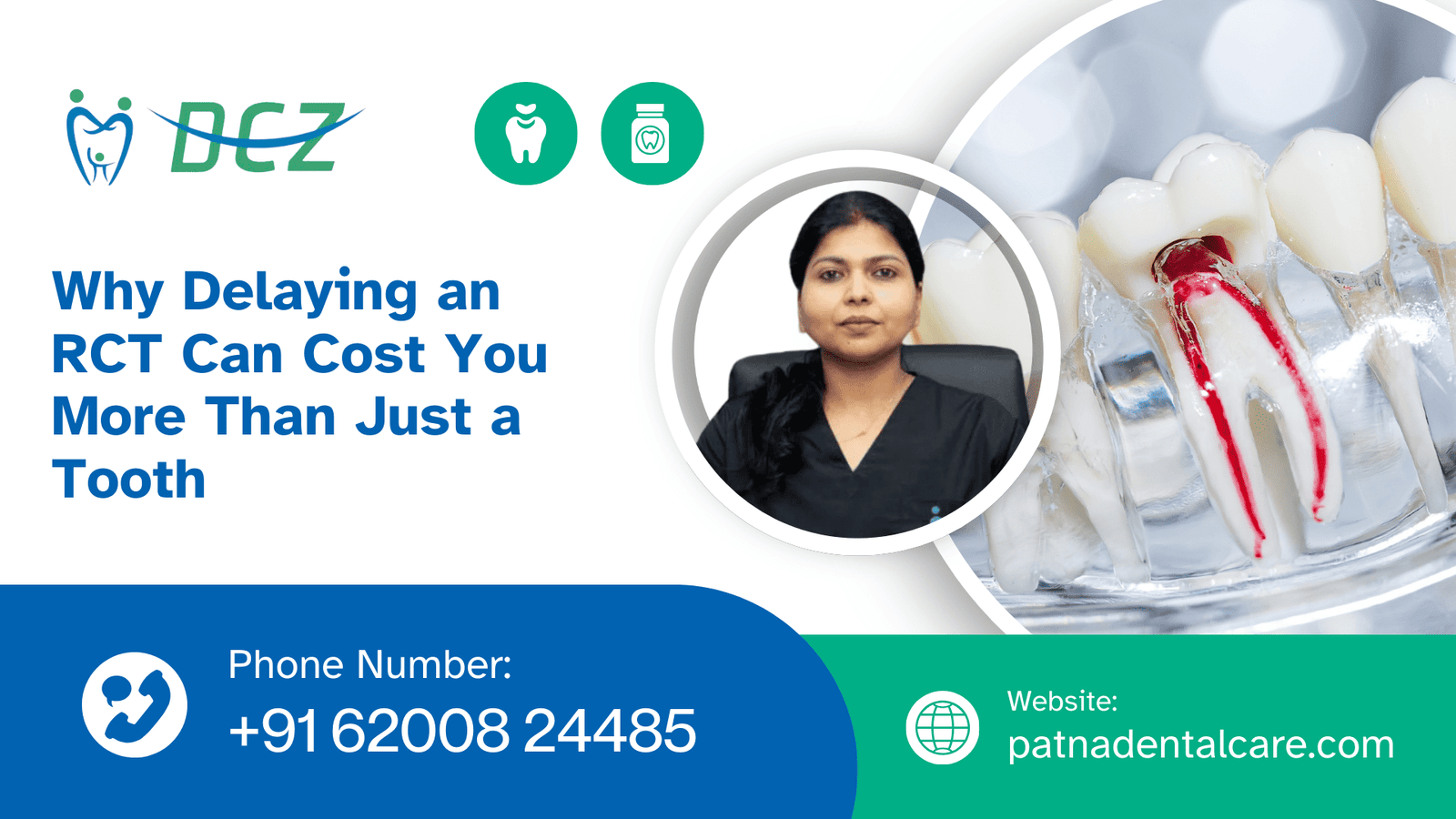 Root Canal in India