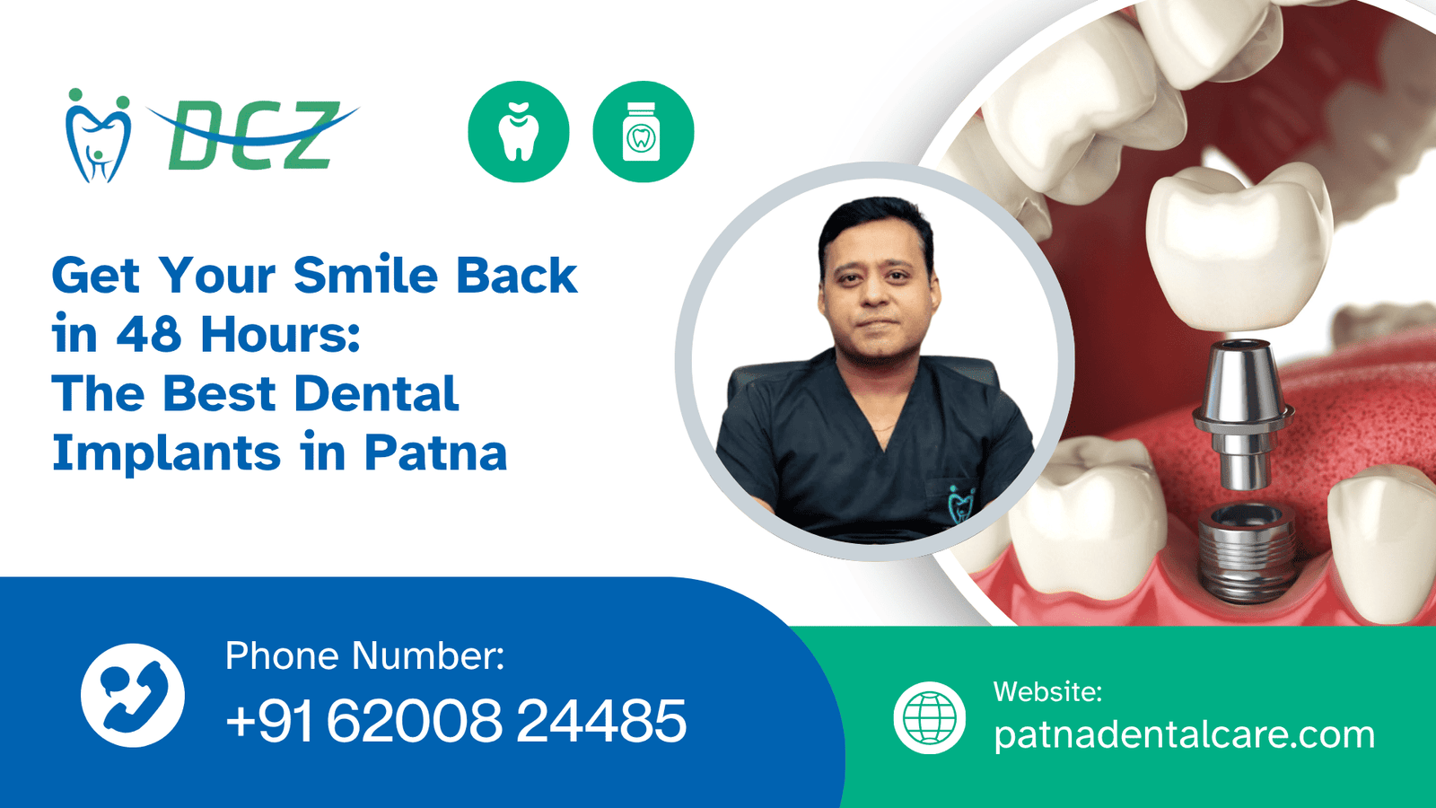 Dental Implants in Patna