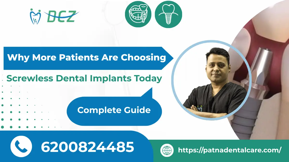 Screwless Dental Implants
