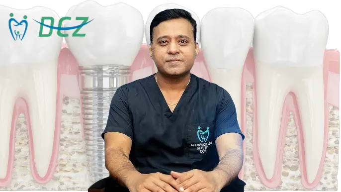 Dental Implants in Patna